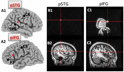 Reverse Engineering Tone-Deafness: Disrupting Pitch-Matching by Creating Temporary Dysfunctions in the Auditory-Motor Network
